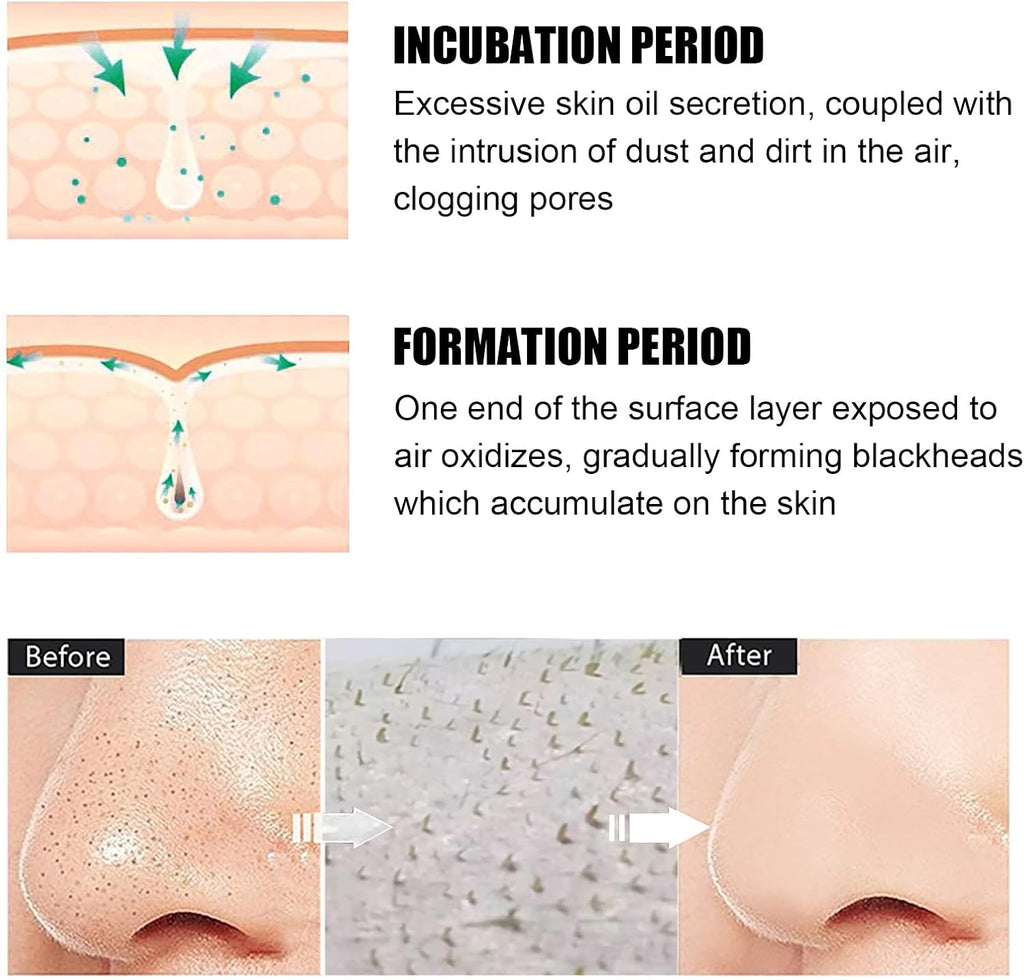 Patch Point Noir, Blackhead Remover Masque, Patch Point Noir Nez, Patchs anti Points Noirs, 30G Masque Peel Off, 60 Pcs Patchs Anti-Points Noirs Pour Le Nez, Nettoyant En Profondeur Rétrécir Pores