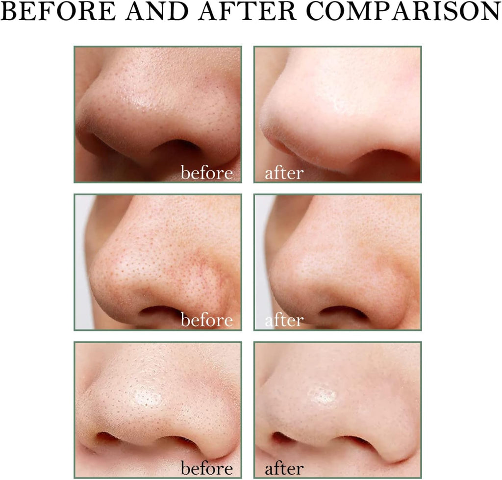 Patch Point Noir, Blackhead Remover Masque, Patch Point Noir Nez, Patchs anti Points Noirs, 30G Masque Peel Off, 60 Pcs Patchs Anti-Points Noirs Pour Le Nez, Nettoyant En Profondeur Rétrécir Pores